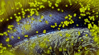 These Are the Best Microscopic Images of 2015